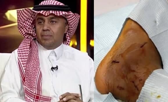 1646564